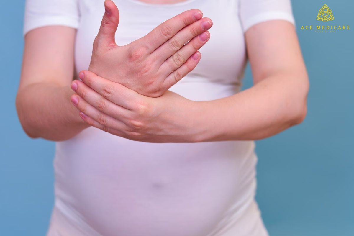Carpal Tunnel Syndrome in Pregnancy: Causes and Management Strategies